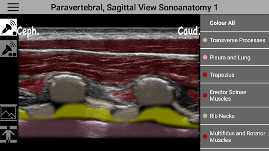 anso-anaesthesia-sonoanatomy-0-18